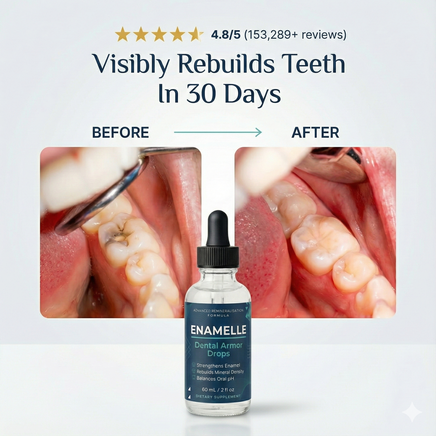 Enamelle Tooth Armor Dental Drops™